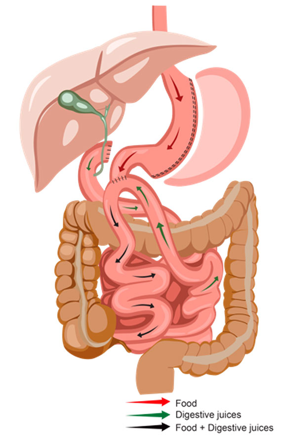 Transit bipartisyon anatomik görünüm