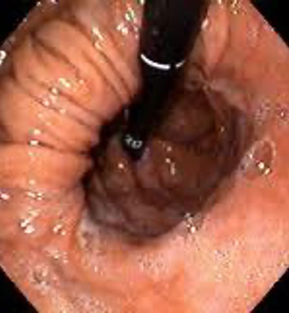 Yüksek Çözünürlük ve NBI?