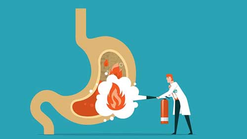 Başarısız Reflü Ameliyatı Sonrası Ne Yapılır?